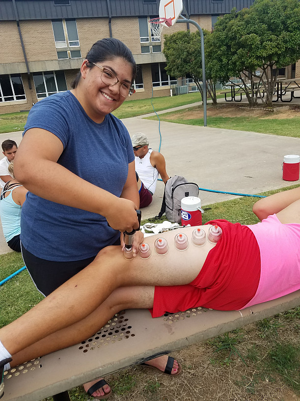 Laura Mister, ATS '19 performing static cupping therapy on a patient